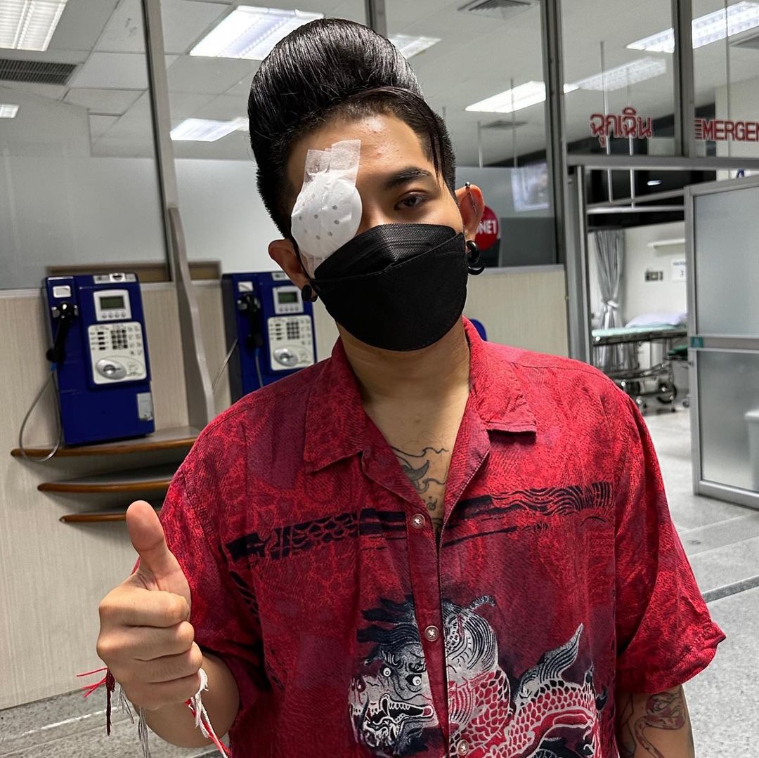 "เก่ง ธชย" เหยื่อบุตาอักเสบ ด้านแฟนๆ แห่เป็นห่วงเพียบ