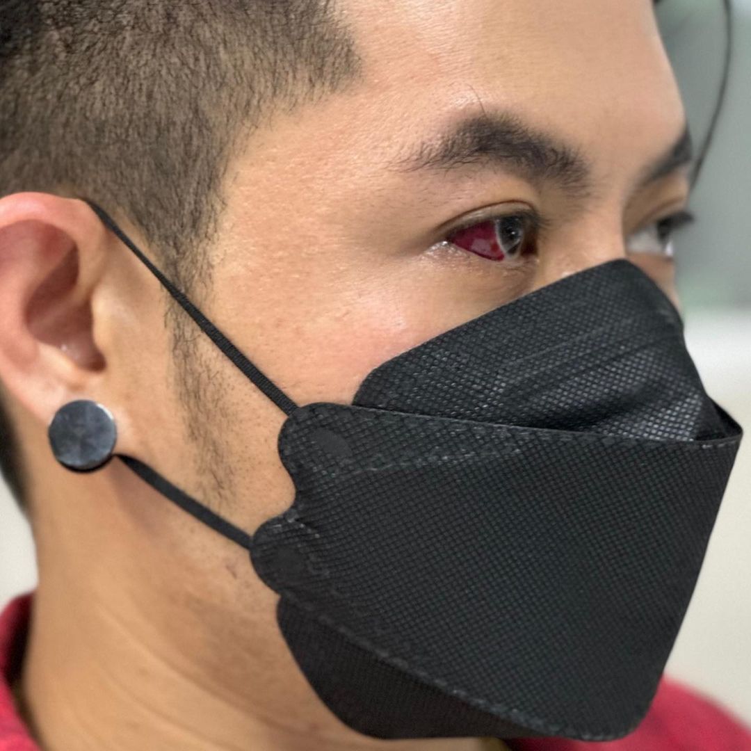 "เก่ง ธชย" เหยื่อบุตาอักเสบ ด้านแฟนๆ แห่เป็นห่วงเพียบ