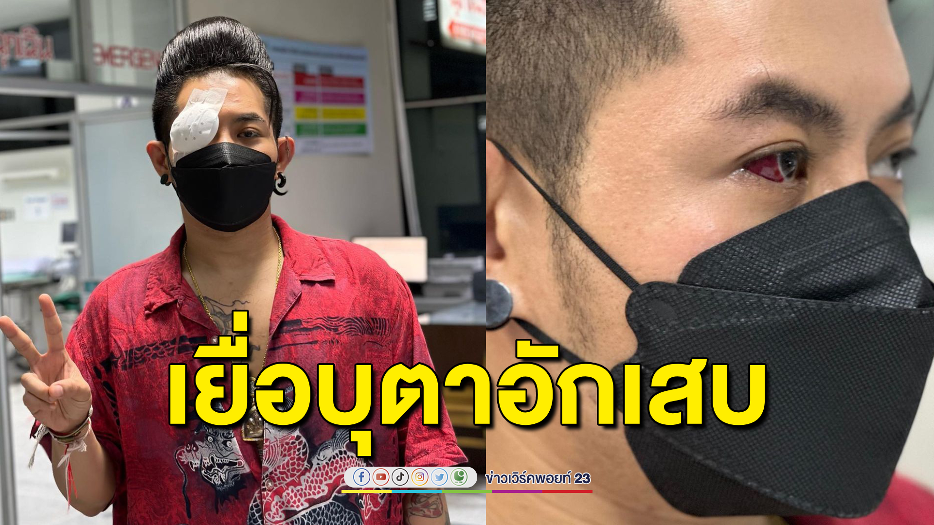 "เก่ง ธชย" เหยื่อบุตาอักเสบ ด้านแฟนๆ แห่เป็นห่วงเพียบ