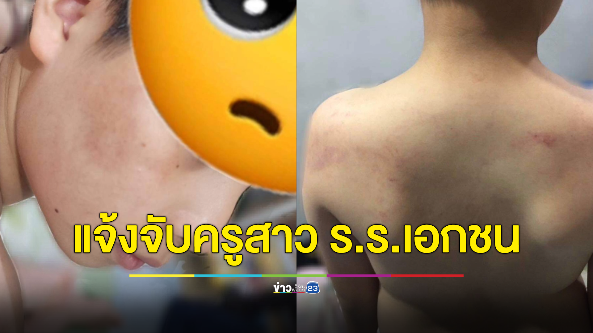 ผู้ปกครองโพสต์ ลูกชายเป็นเด็กพิเศษ ถูกครูสาวโรงเรียนเอกชนตบหน้าทำโทษ ร้องไห้ขอความเป็นธรรม