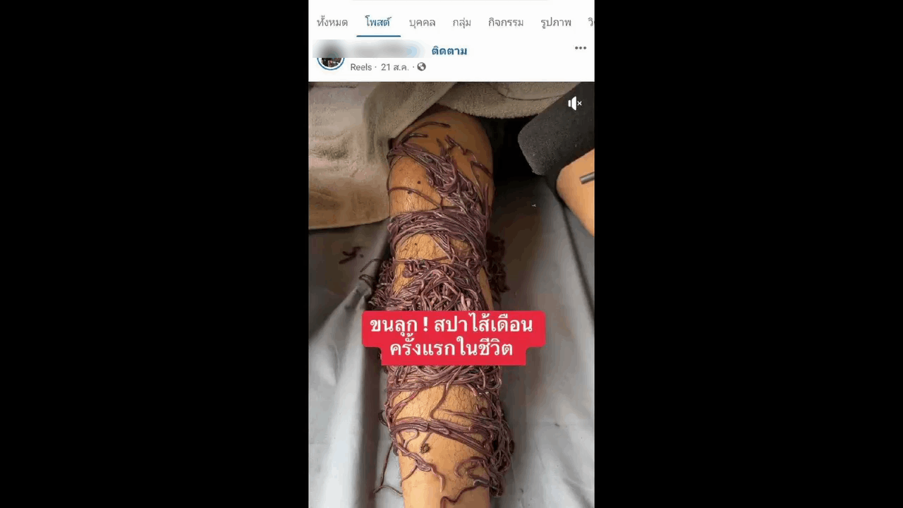 เตือน! สปาไส้เดือน เสี่ยงเชื้อเข้าร่างกาย