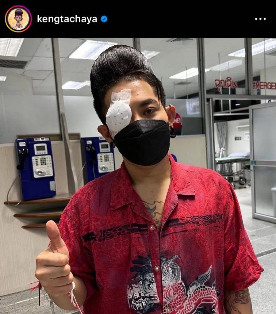 กลัวตาบอด! “เก่ง ธชย” เส้นเลือดฝอยตาขาวแตก รักษาไม่หาย หวั่นลุกลาม