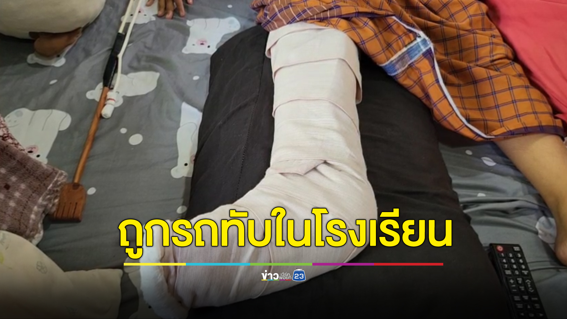 เด็ก 13 ถูกรถนักเรียนทับขาหัก ผ่านมา 5 วันผู้บริหารยังไม่มาเหลียวแล