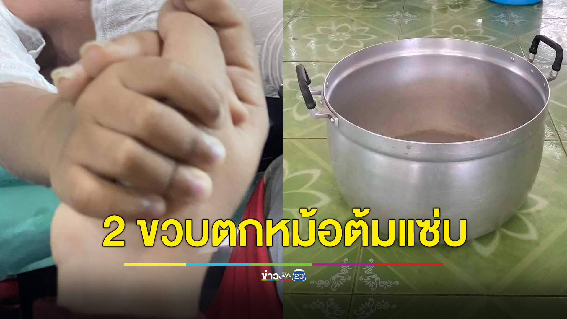 พ่อแม่ร้อง “ปวีณา” ลูกน้อย 2 ขวบตกหม้อต้มแซ่บร้อนๆ เจ็บสาหัส