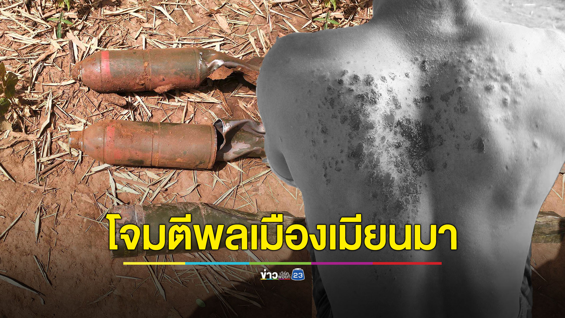 พลเมืองเมียนมาถูกโจมตีเสียชีวิต 2 ราย