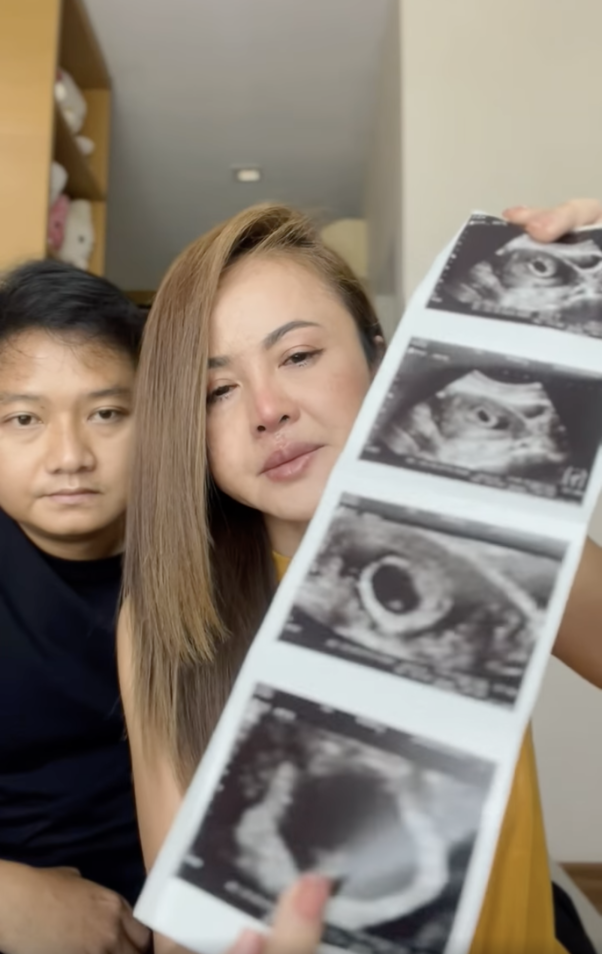 เศร้าหนัก! "ลำยอง หนองหินห่าว" แจ้งข่าวร้าย สูญเสียลูกน้อยในครรภ์กะทันหัน