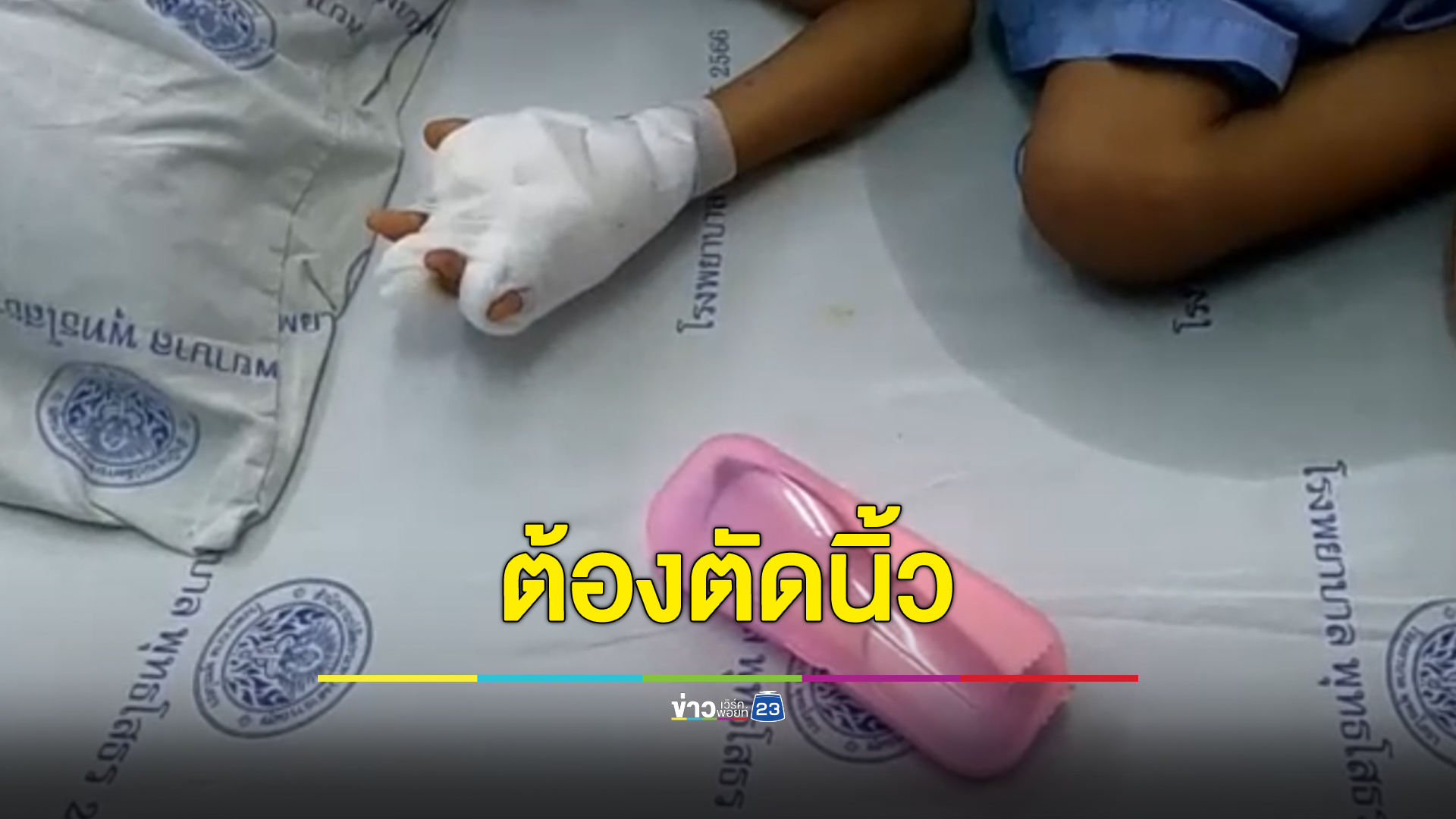 ตัดนิ้ว ด.ช. วัย 6 ขวบ โดนระเบิดใส่มือเจ็บหนัก