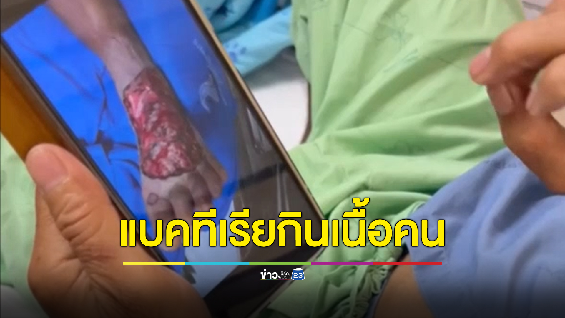 ชาวนาแม่สายลุยน้ำเกี่ยวข้าว กลับมาติดเชื้อแบคทีเรียกินเนื้อ