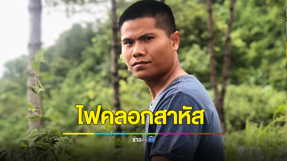 จินนี่ ภูไท นักแต่งเพลงลูกทุ่งดัง ถูกไฟคลอกอาการสาหัส