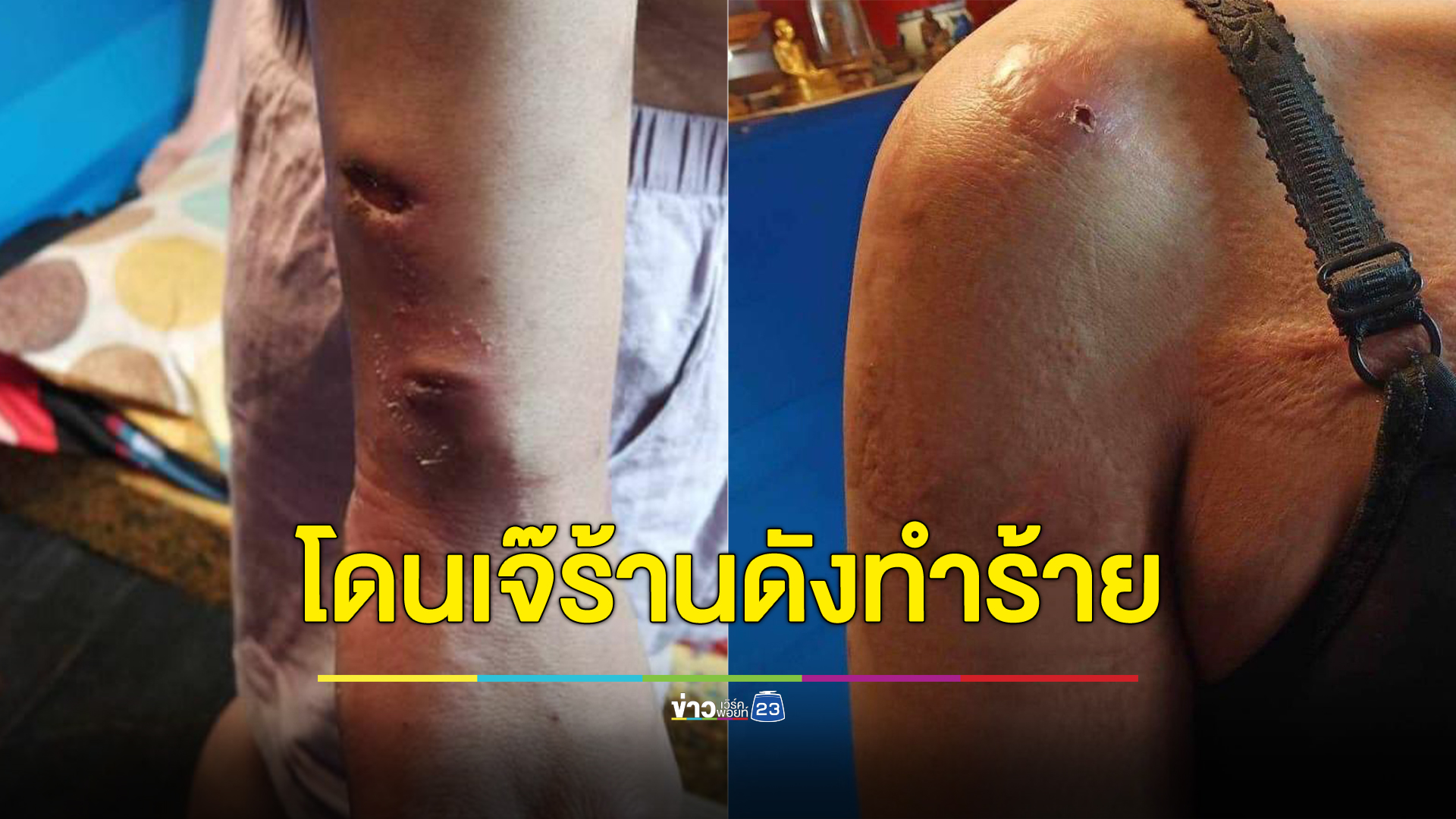 “สายไหมต้องรอด”เตรียมพาลูกจ้างสาวถูกเจ๊เจ้าของร้านอาหารชื่อดังในกทม.ทารุณเยี่ยงสัตว์นานนับปีจนเกือบพิการ