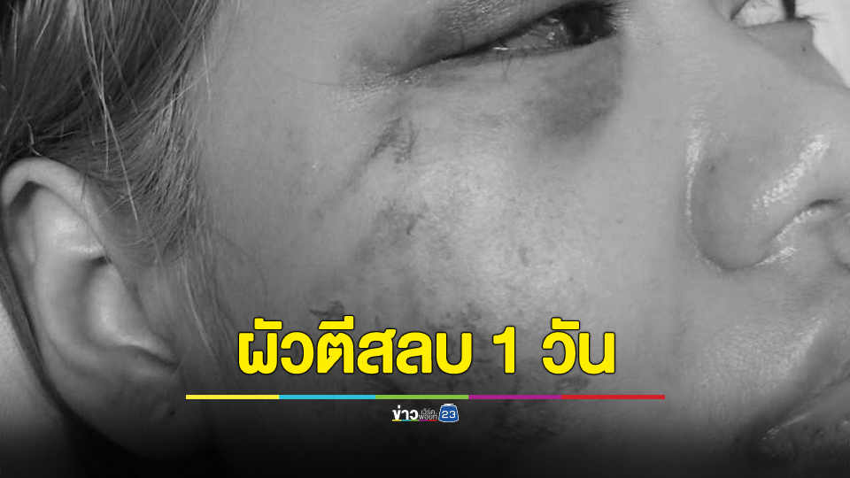 สาวร้องเพจดัง ถูกผัวตีสลบขณะท้อง 2 เดือน