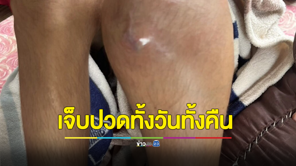 สุดสงสารเด็กหญิงป่วยมะเร็งกระดูก ร้องไห้ด้วยความเจ็บปวดทั้งวันทั้งคืน