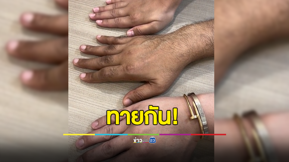 รู้ไหม? ใครเป็นโรคภูมิแพ้สะเก็ดเงิน