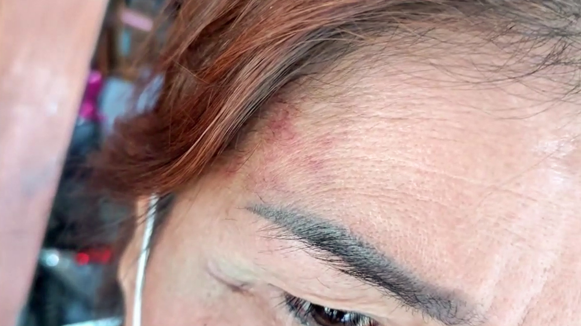 หลานชายหลอนยาทำร้ายยายปางตาย อ้างแค้นแบ่งมรดกไม่เท่ากัน
