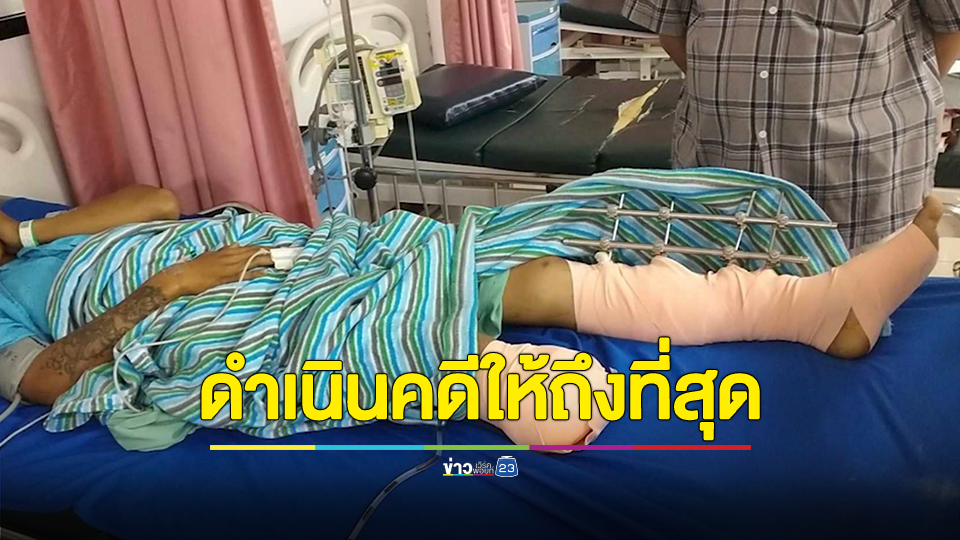 แม่เป็นลมเข้า รพ. หลังทราบข่าวลูกชายขาขาด ปมกระบะเข้าใจผิดคิดว่าเป็นอริลูกชาย ลั่นดำเนินคดีให้ถึงที่สุด ทำให้คนที่เป็นเสาหลักของครอบครัวต้องมาเดือดร้อน