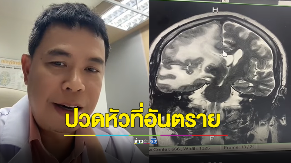 เช็กด่วน! ปวดหัวแบบไหนอันตรายกลายเป็นเนื้องอก