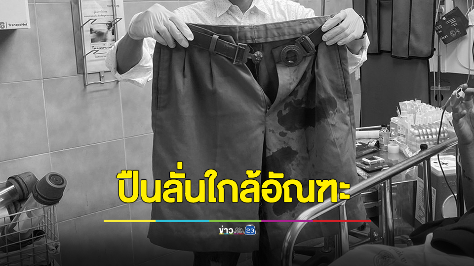 นักเรียนขาสั้นปืนลั่นโดนโคนขาใกล้อัณฑะ กระสุนทะลุไปถูกขาเพื่อนที่ซ้อนท้าย