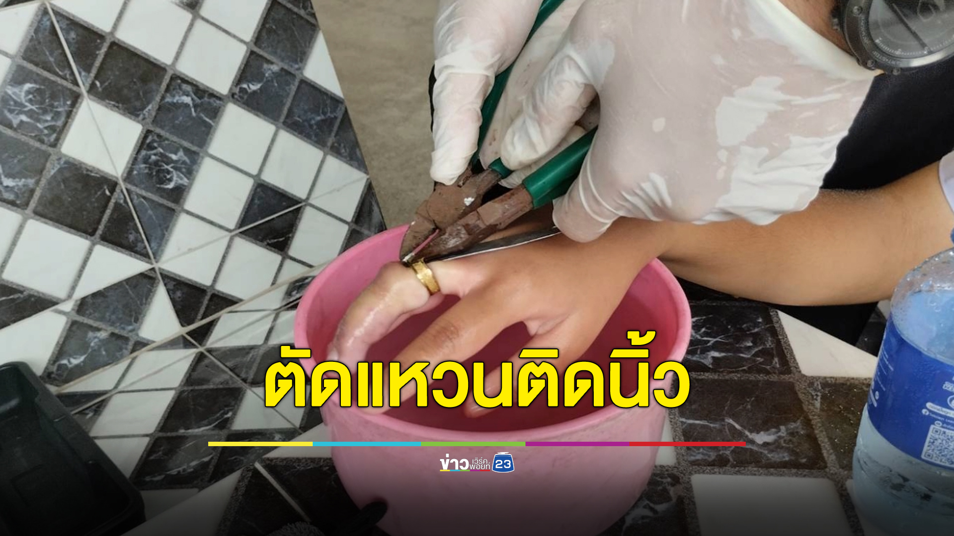 กู้ภัยฯช่วยตัดแหวนติดนิ้วนักเรียนหญิงป. 6 หลังใส่มานานจนอักเสบบวม