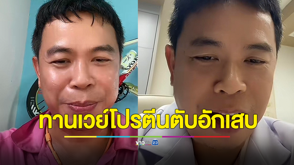 หมอประชาแชร์ประสบการณ์ตรงจากตัวเองหลังทานเวย์โปรตีน หวังสร้างกล้ามเนื้อเวลาออกกำลังกาย ปรากฏว่าไปตรวจเลือดดูค่าเลือดเอนไซม์ต่ำขึ้น