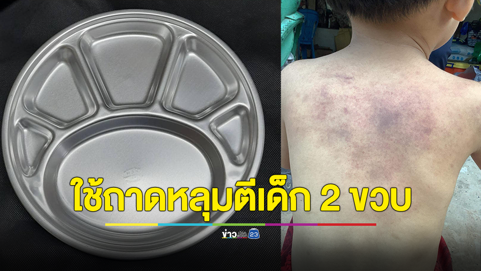 พ่อร้องลูกชาย 2 ขวบ ถูกครูโรงเรียนแห่งหนึ่งในจ.ร้อยเอ็ด ใช้ถาดข้าวที่เป็นเหล็กฟาดหลังจนร่างกายมีบาดแผลฟกช้ำ