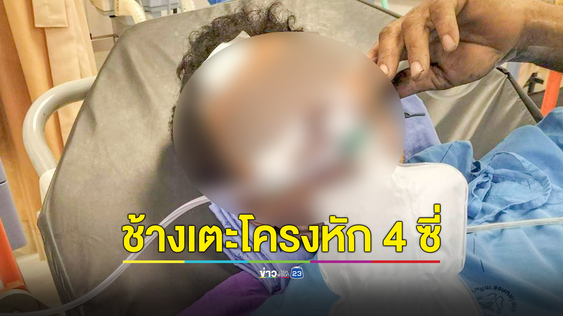 ชาวบ้านไปหาเห็ดเจอช้างป่าขวางหน้า วิ่งหนีไม่ทันโดนเตะซี่โครงหัก 4 ซี่