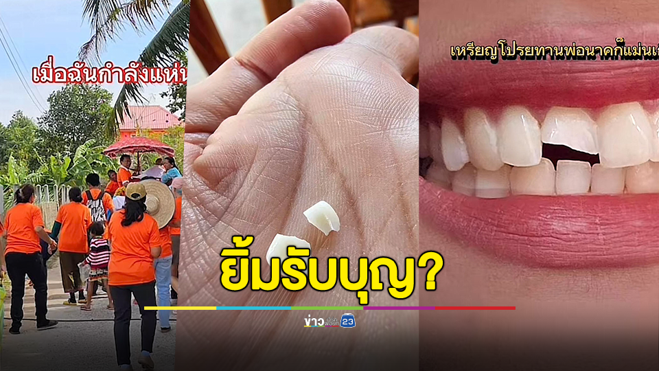 โอกาสเกิด 1 ในล้าน! สาวไปงานบวช เหรียญโปรยทานกระเด็นมาโดนฟันหัก ลั่น บุญหนักเกิน