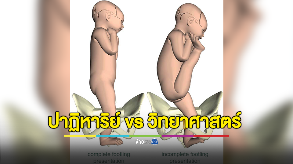 เจ้าชายสิทธัตถะ เกิดแล้วเดินได้ 7 ก้าว มีดอกบัวผุด จริงหรือเปล่า? ปาฏิหาริย์ vs วิทยาศาสตร์