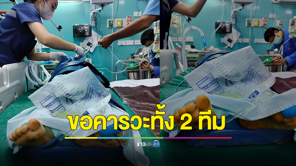 ขอคารวะทั้ง 2 ทีม! 2 รพ. จ.แม่ฮ่องสอน ช่วยเด็ก 5 ขวบ ซดไซยาไนด์โคม่านัดพบกันครึ่งทางจนปลอดภัย
