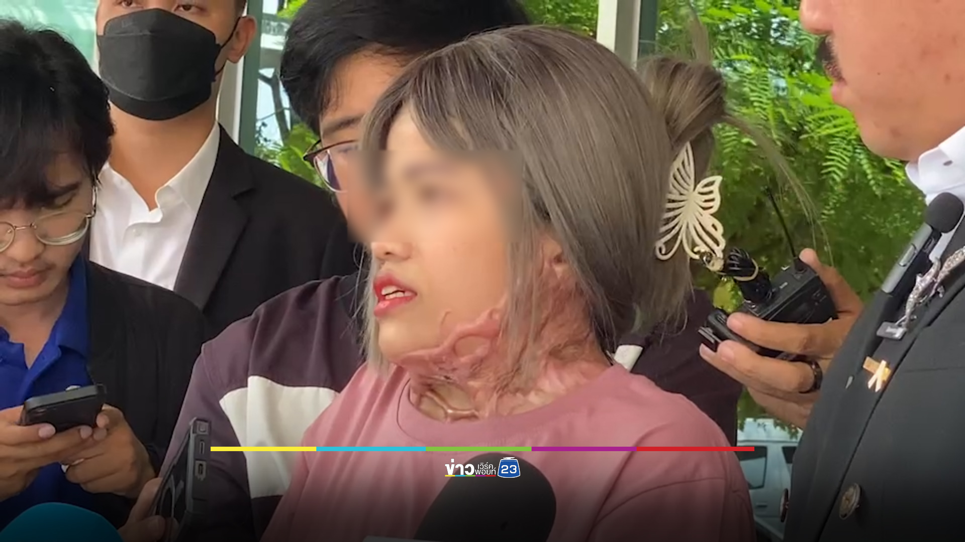 “กัน จอมพลัง” ช่วยสาวถูกสาดน้ำกรด ขยายเวลารักษาตัวในไทย