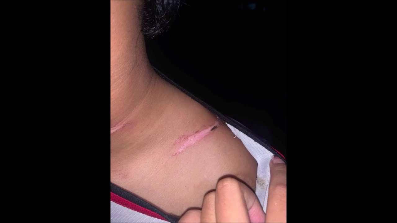 ชาวบ้านผวา! ขอ ตร. ช่วยควานตัวโจ๋คลั่งยา ขึงลวดสลิงกลางถนน-ปาบึ้มป่วนเมือง