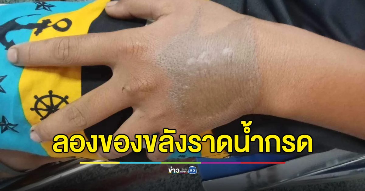 จ้าง 200! ลองของขลัง พระราดน้ำกรดใส่มือเด็ก
