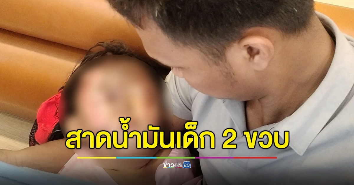 ทวงหนี้ค่าห้องเช่าไม่ได้ ยกหม้อน้ำมันร้อนๆ สาดเข้าหน้าเด็ก 2 ขวบ