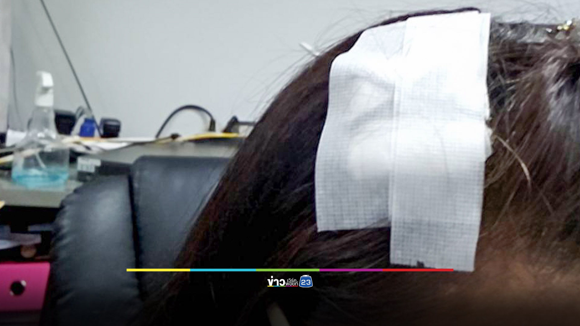 สาวเดินชนพูลบ๊อกซ์หัวแตก ถามติดตั้งต่ำไปไหม?
