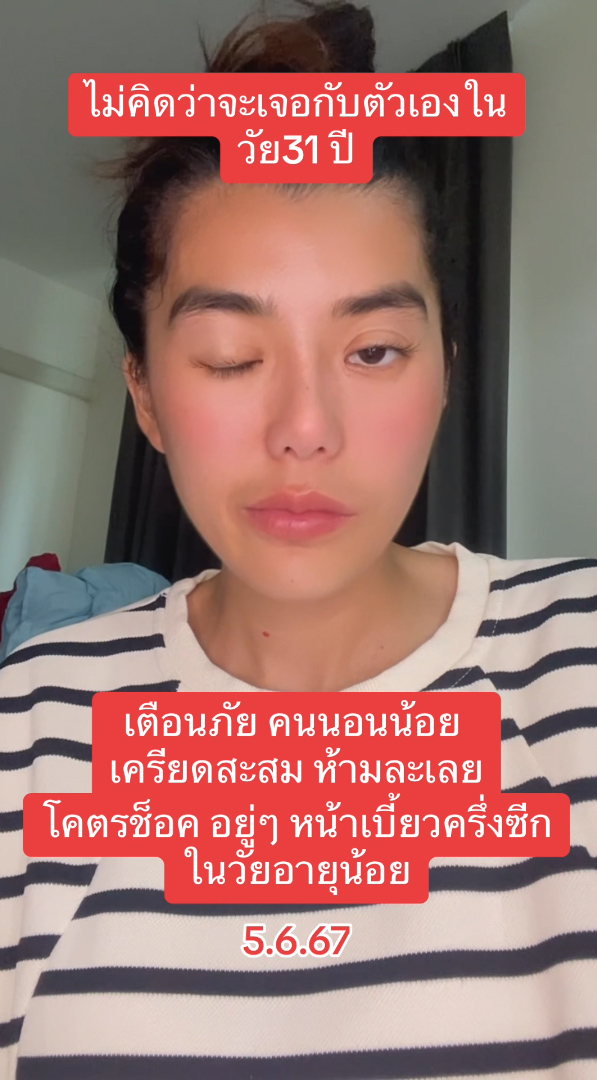 สาวช็อกตื่นมาหน้าเบี้ยวครึ่งซีก เล่าอาการเริ่มแรกที่ต้องระวัง