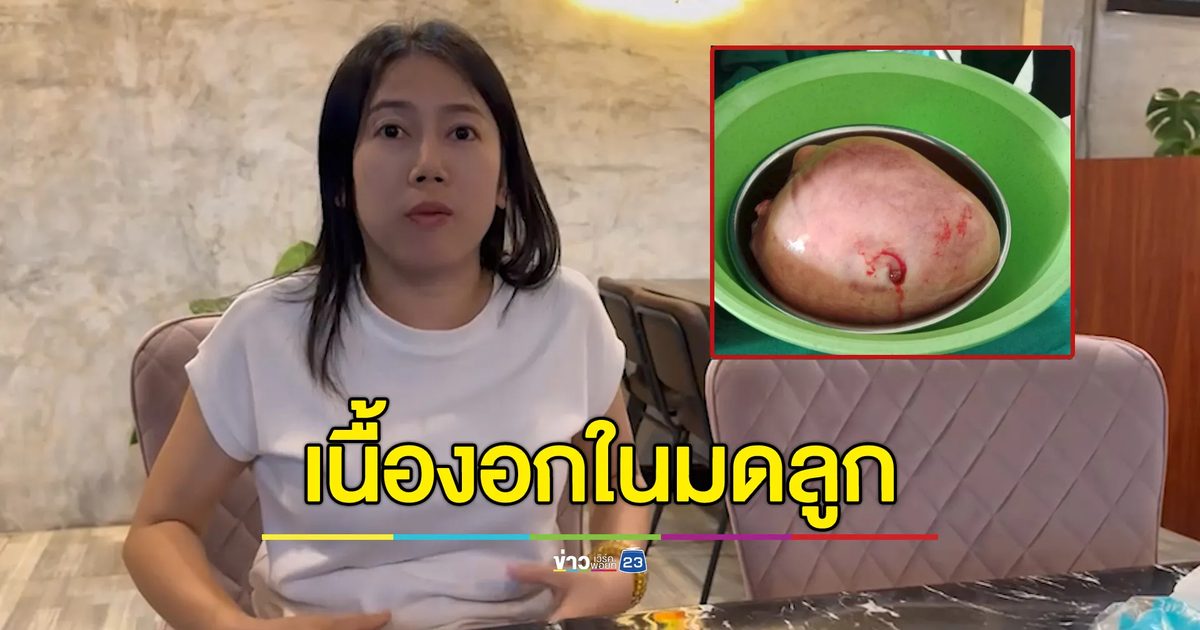 สาวมุกดาหารเจอเนื้องอกในมดลูกใหญ่เท่ากะละมัง