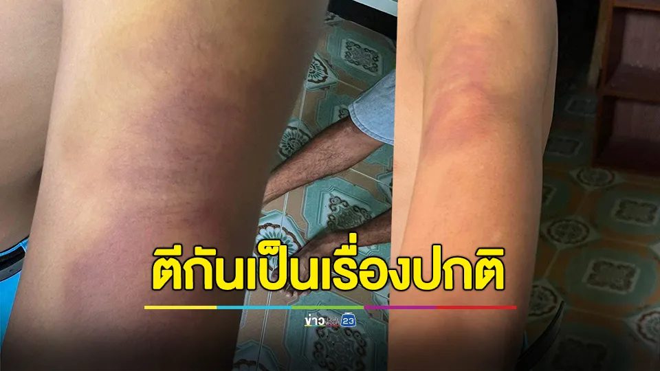 ผู้ปกครองร้อง! ลูกชายอยู่รร.ประจำ ถูกรุ่นพี่และเพื่อนรุมทำร้าย