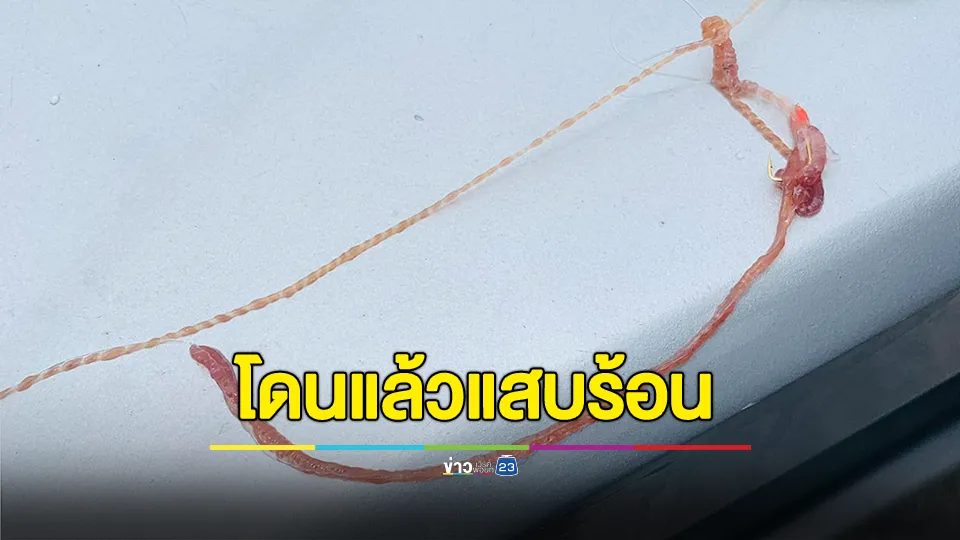 หนุ่มสงสัย? นี่คือตัวอะไร เอามือไปจับเหมือนโดนเข็มทิ่มตามด้วยแสบร้อน