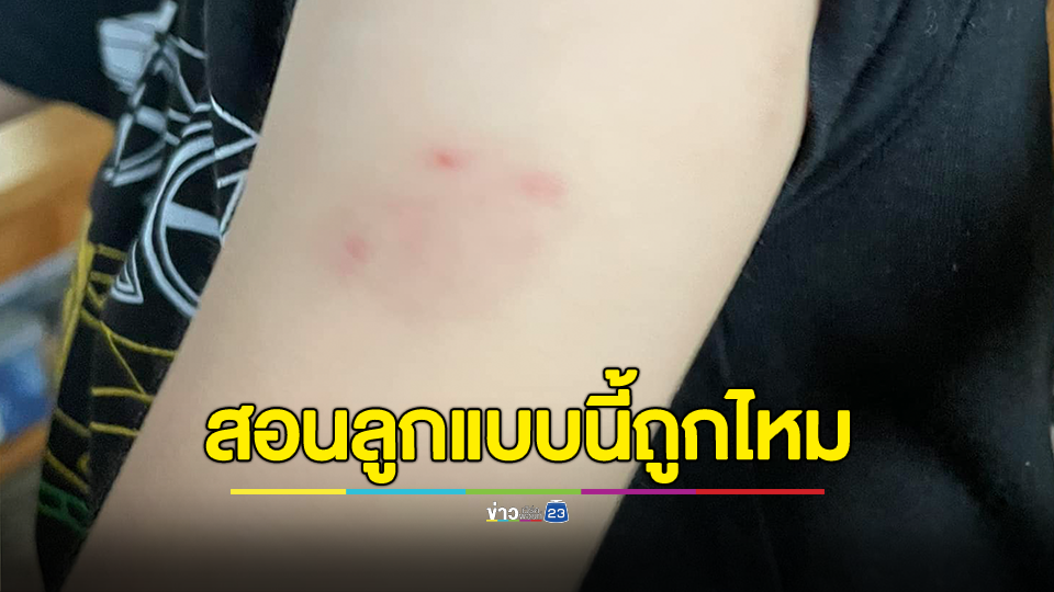 แม่ปรึกษาสอนลูกแบบนี้ถูกไหม? หลังลูกถูกเพื่อนที่โรงเรียนกัด ให้ตะโกนแล้วรีบวิ่งไปหาครู