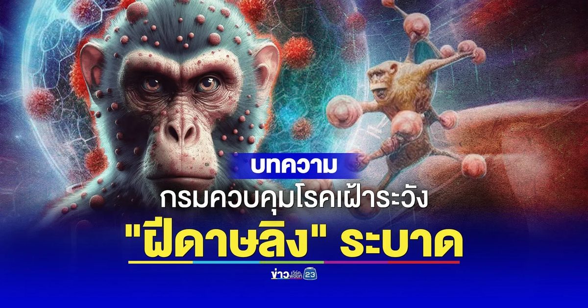 กรมควบคุมโรคเตือน เฝ้าระวัง “ฝีดาษลิง” ระบาด