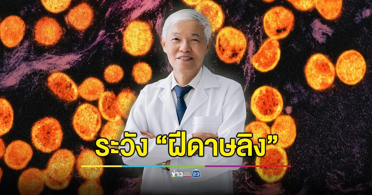 “หมอยง” เตือนระวัง “ฝีดาษลิง” เจอป่วยในไทยแล้วกว่า 400 ราย