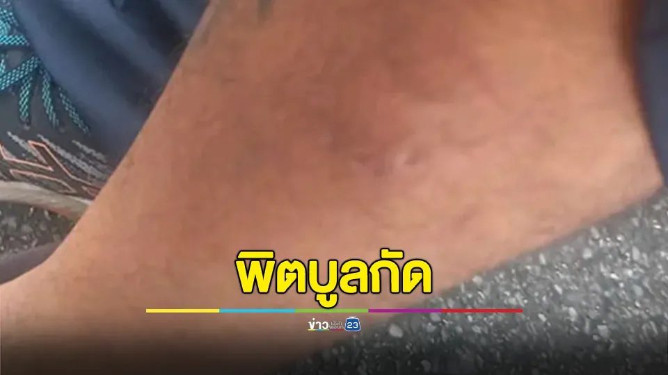 หมาคุณไม่ได้น่ารักสำหรับทุกคน! ร้องถูกพิตบูลกัด งงคนเดินพลุกพล่าน ไม่มีใครล่ามไว้เลย