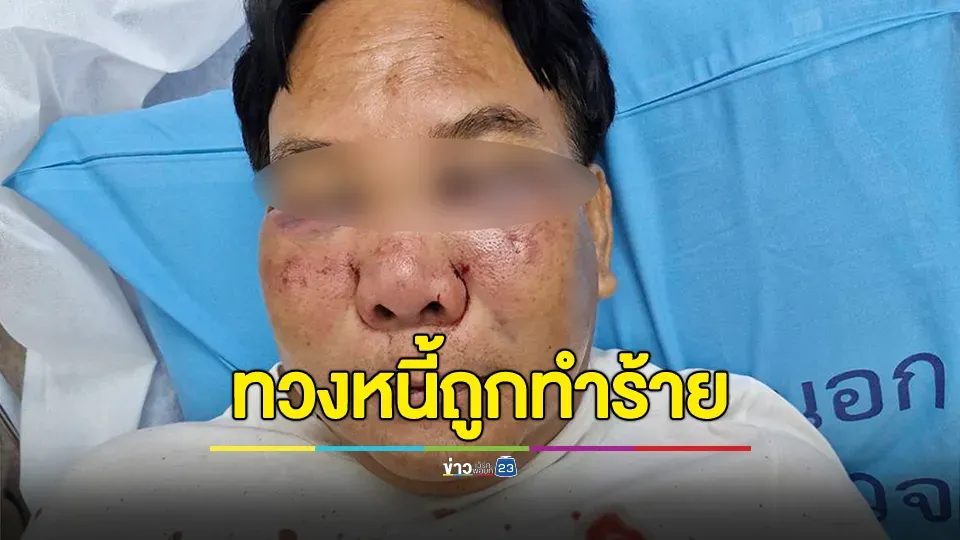 ลูกร้องพ่อถูกลูกหนี้ทำร้ายร่างกาย หลังทวงหนี้คงค้าง 5,000 บาท