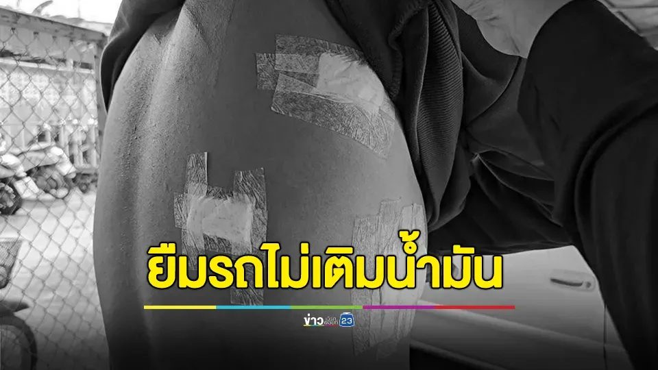 หนุ่มวัย 20 ปี ถูกเพื่อนเก่ายกพวกมารุมฟันบาดเจ็บ