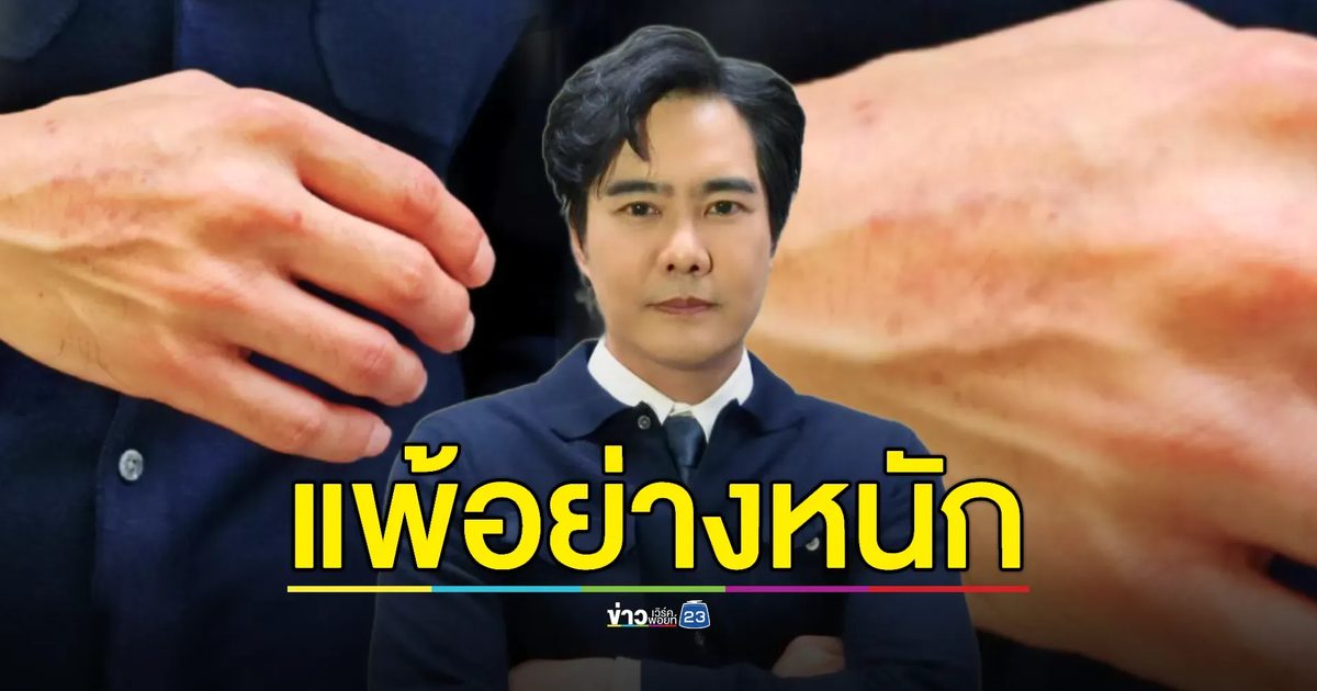 “เคลลี่” เร่งทำบ้าน! เกิดอาการแพ้-รอยแดงขึ้นตามตัว