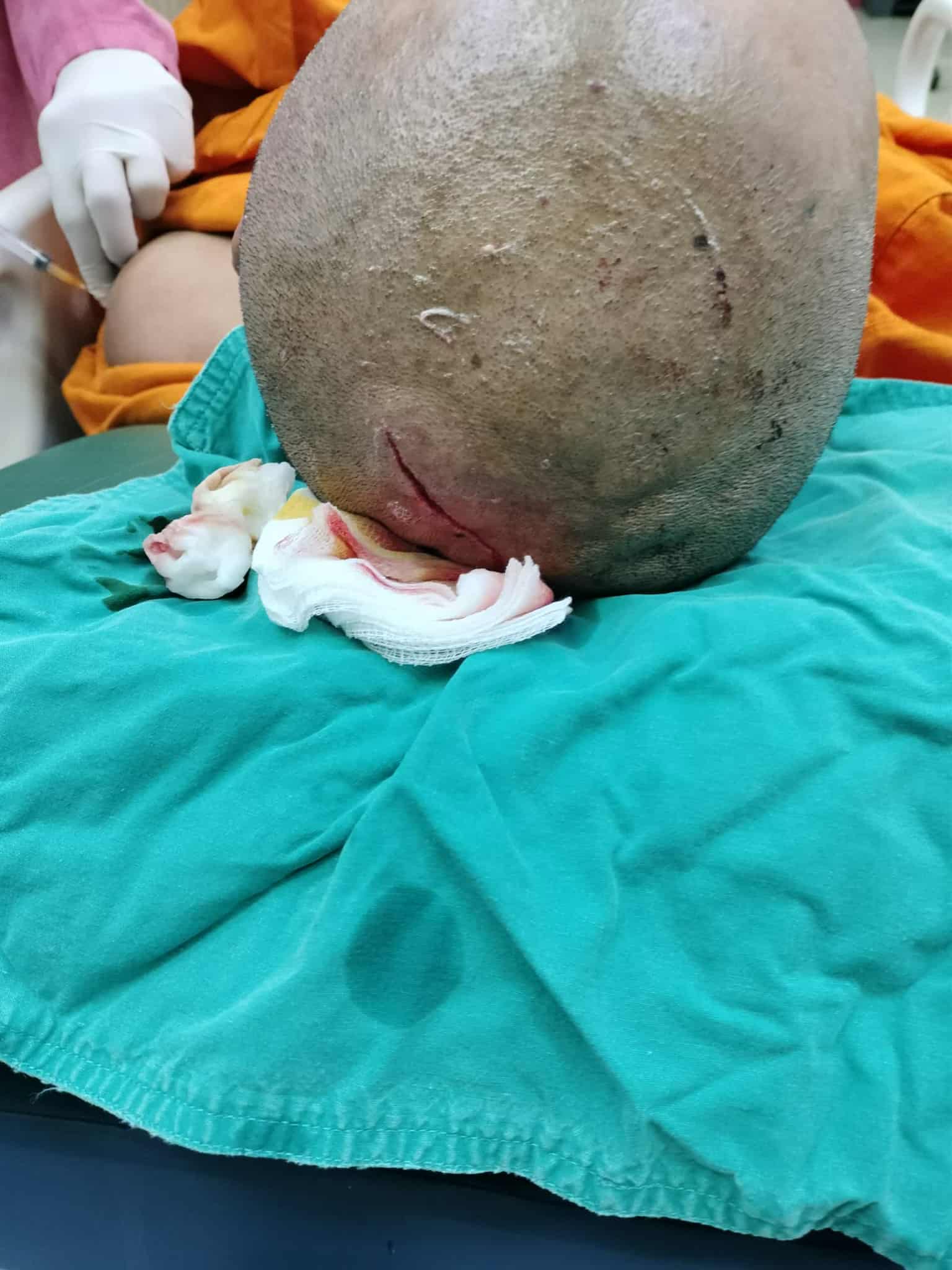 เจ้าอาวาสตื้บพระลูกวัดกลางวัด อ้างทำโทษเพราะจับได้เสพยา