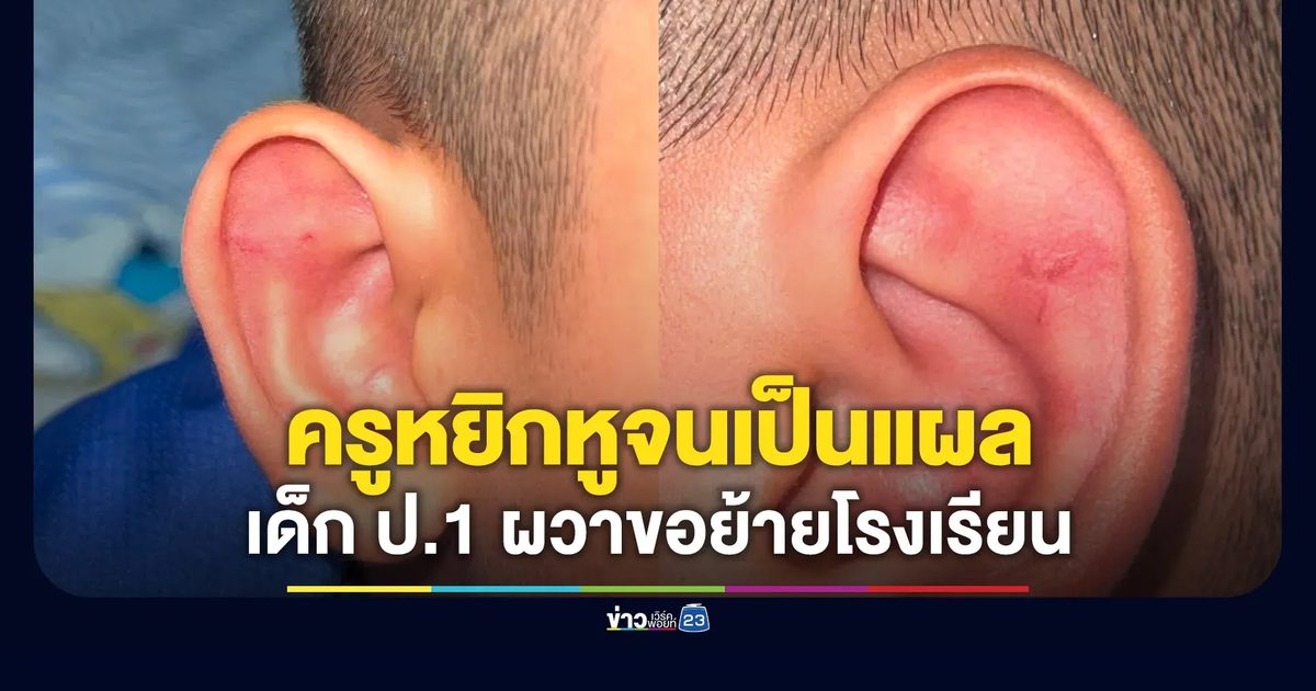 ครูหยิกหูเป็นแผล เด็ก ป.1 ผวาขอย้ายโรงเรียน
