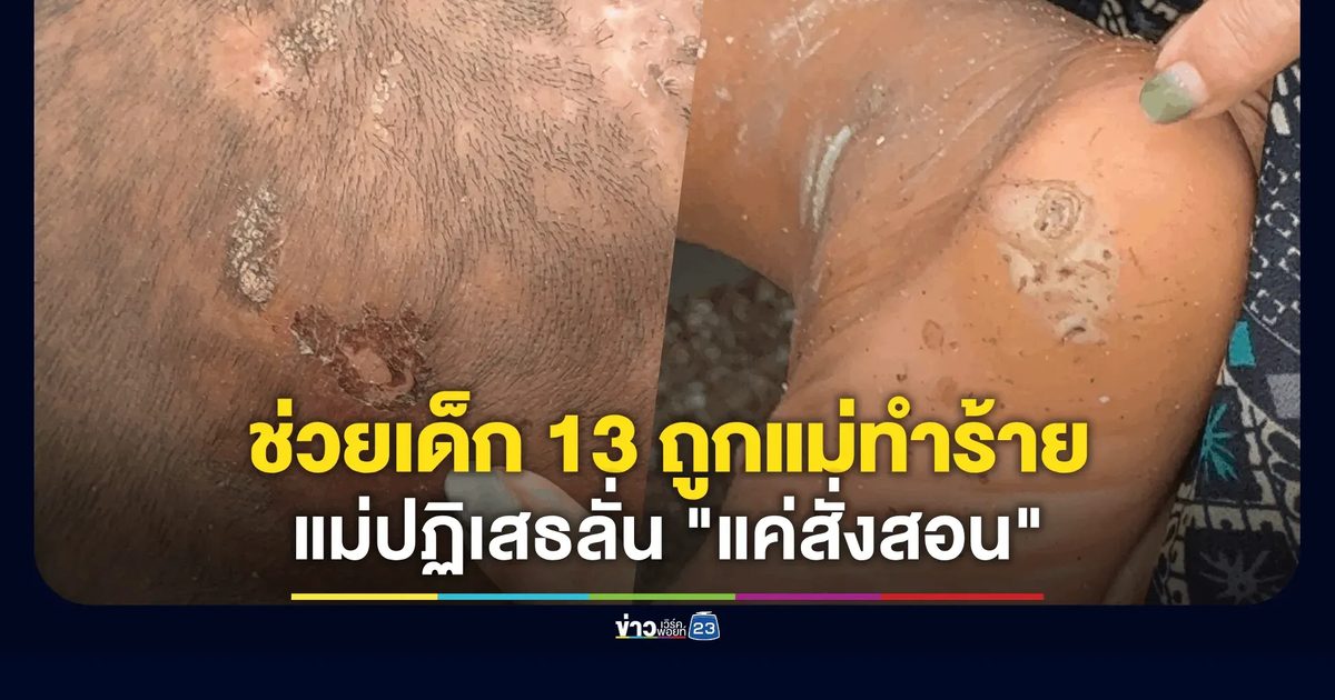 ร้องช่วย ด.ญ. ถูกแม่ทำร้าย-ไล่นอนนอกบ้าน