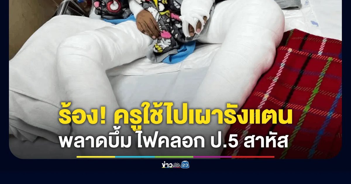 แม่ร้องสายไหมต้องรอด ครูใช้ให้นักเรียนจุดไฟไล่รังแตน พลาดบึ้มสนั่นไฟคลอกสาหัส ไร้เยียวยาต่อเนื่อง