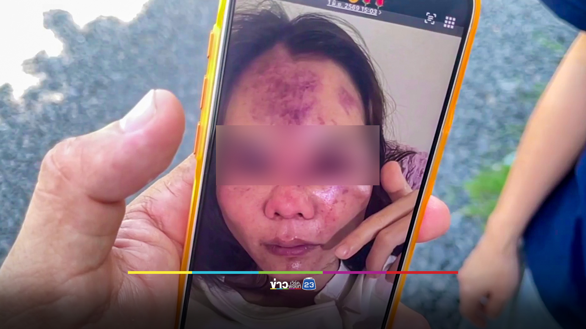 คนร้ายแฝงตัวเป็นลูกค้า ทำร้ายหมอนวดสาวปางตาย ชิงทรัพย์หลบหนี