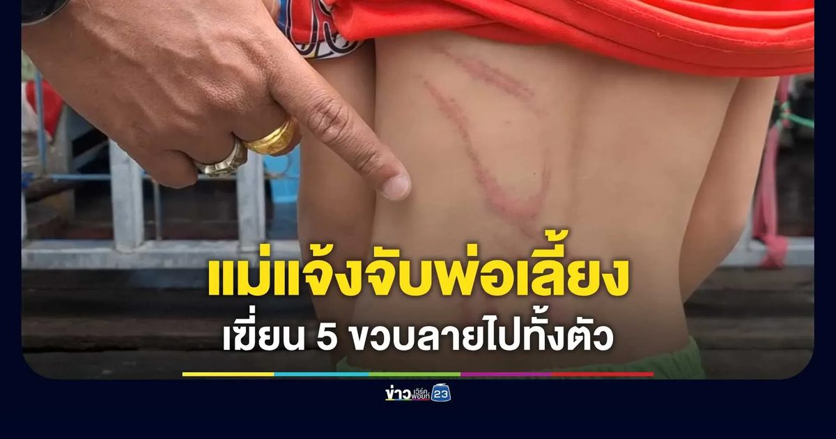 แม่พาลูกชายวัย 5 ขวบ เข้าแจ้งความ หลังถูกพ่อเลี้ยงเฆี่ยน